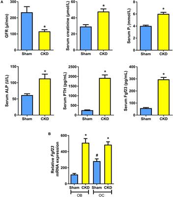 Augmented Fibroblast Growth Factor-23 Secretion in Bone Locally Contributes to Impaired Bone Mineralization in Chronic Kidney Disease in Mice